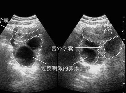 南宁试管婴儿私立医院怎么样？私立医院要比你想象中的好！